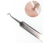 acne pinzette in Acciaio Inox per eliminare l'acne Punti Neri Brufoli