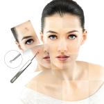 acne pinzette in Acciaio Inox per eliminare l'acne Punti Neri Brufoli